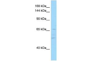 WB Suggested Anti-IL16 Antibody Titration: 1. (IL16 抗体  (C-Term))