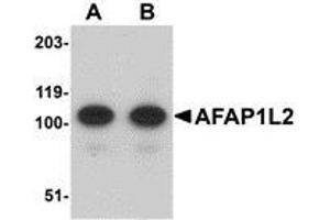 Western blot analysis of AFAP1L2 in mouse liver tissue lysate with AP30026PU-N AFAP1L2 antibody at (A) 1 and (B) 2 μg/ml. (AFAP1L2 抗体  (C-Term))