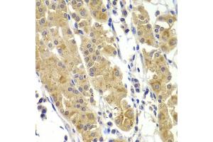 Immunohistochemistry of paraffin-embedded human stomach using MMP14 antibody (ABIN5971375) at dilution of 1/100 (40x lens).
