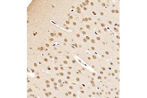 Immunohistochemistry (Paraffin-embedded Sections) (IHC (p)) image for anti-NSFL1 (p97) Cofactor (p47) (NSFL1C) antibody (ABIN7074865)