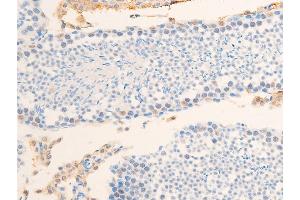 ABIN6267234 at 1/100 staining mouse testis tissue sections by IHC-P. (Survivin 抗体  (pThr117))