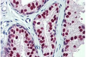 Human Prostate: Formalin-Fixed, Paraffin-Embedded (FFPE) (CUL9 抗体)