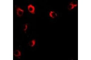 Immunofluorescent analysis of VILIP-1 staining in U2OS cells. (VSNL1 抗体)
