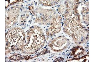 Immunohistochemical staining of paraffin-embedded Human Kidney tissue using anti-TUBAL3 mouse monoclonal antibody. (TUBAL3 抗体  (AA 150-446))