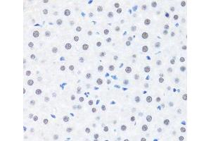 Immunohistochemistry of paraffin-embedded Rat liver using BRMS1 Polyclonal Antibody at dilution of 1:100 (40x lens). (BRMS1 抗体)