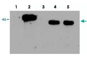 Western Blot analysis of human EGLN1, using EGLN1 polyclonal antibody . (EGLN1 抗体)