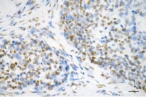 anti-DEAD (Asp-Glu-Ala-Asp) Box Polypeptide 5 (DDX5) antibody