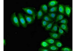 Immunofluorescent analysis of A549 cells using ABIN7168341 at dilution of 1:100 and Alexa Fluor 488-congugated AffiniPure Goat Anti-Rabbit IgG(H+L) (RBM38 抗体  (AA 1-239))