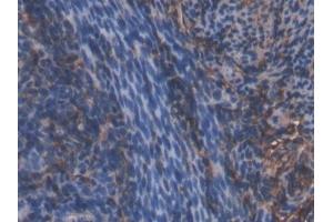 Detection of HMWK in Mouse Uterus Tissue using Polyclonal Antibody to High Molecular Weight Kininogen (HMWK) (Kininogen (HMW) 抗体  (AA 268-540))