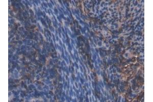 Detection of HMWK in Mouse Uterus Tissue using Polyclonal Antibody to High Molecular Weight Kininogen (HMWK)