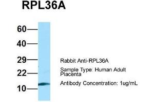 Host: Rabbit  Target Name: RPL36A  Sample Tissue: Human Adult Placenta  Antibody Dilution: 1. (RPL36AL 抗体  (C-Term))