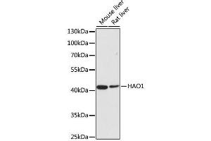 Western blot analysis of extracts of various cell lines, using HAO1 antibody. (HAO1 抗体  (AA 1-370))