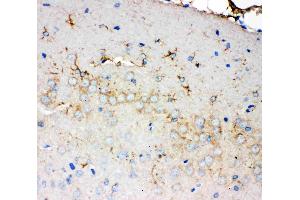 Anti-PMP70 antibody, IHC(P): Rat Brain Tissue (CX3CL1 抗体  (C-Term))
