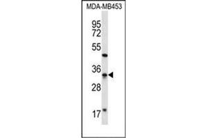 Western blot analysis of FTSJ1 Antibody (N-term) in MDA-MB453 cell line lysates (35ug/lane). (FTSJ1 抗体  (N-Term))