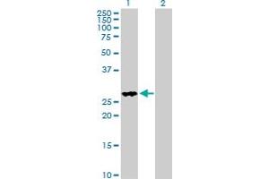 Western Blot analysis of FHL2 expression in transfected 293T cell line by FHL2 MaxPab polyclonal antibody. (FHL2 抗体  (AA 1-279))