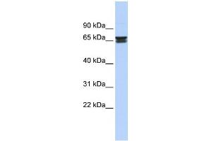 WB Suggested Anti-ZNF614 Antibody Titration:  0. (ZNF614 抗体  (Middle Region))