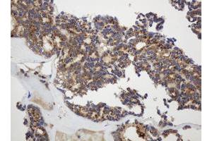 Image no. 1 for anti-Glyceraldehyde-3-Phosphate Dehydrogenase, Spermatogenic (GAPDHS) antibody (ABIN1498375) (GAPDHS 抗体)