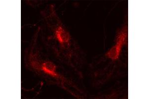 Immunocytochemistry (ICC) image for anti-VAMP (Vesicle-Associated Membrane Protein)-Associated Protein A, 33kDa (VAPA) (AA 1-223) antibody (ABIN1742504) (VAPA 抗体  (AA 1-223))