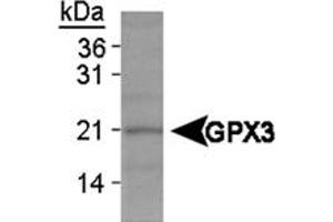 Western blot analysis of GPX3 on HeLa whole cell extracts using GPX3 polyclonal antibody . (GPX3 抗体)