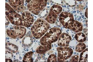 Immunohistochemical staining of paraffin-embedded Human Kidney tissue using anti-GRHPR mouse monoclonal antibody. (GRHPR 抗体)