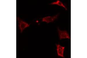 ABIN6274315 staining Hela cells by IF/ICC. (MVK 抗体  (Internal Region))