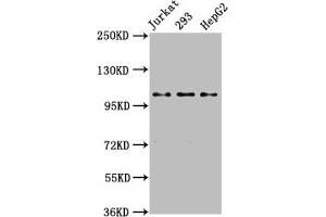 Western Blot Positive WB detected in: Jurkat whole cell lysate, 293 whole cell lysate, HepG2 whole cell lysate All lanes: KIF5B antibody at 3. (KIF5B 抗体  (AA 338-514))