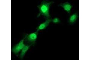 Anti-TMOD1 mouse monoclonal antibody (ABIN2454774) immunofluorescent staining of COS7 cells transiently transfected by pCMV6-ENTRY TMOD1 (RC201134). (Tropomodulin 1 抗体)