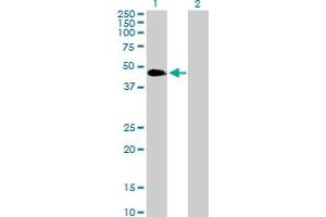 Western Blot analysis of VASP expression in transfected 293T cell line by VASP MaxPab polyclonal antibody. (VASP 抗体  (AA 1-380))