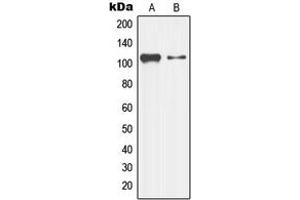 Western blot analysis of LZK expression in K562 (A), HepG2 (B) whole cell lysates. (MAP3K13 抗体  (Center))