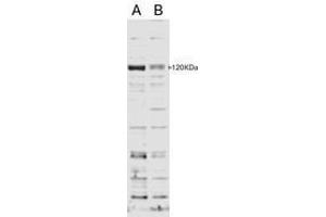 Image no. 1 for anti-SECIS Binding Protein 2 (SECISBP2) (AA 545-557) antibody (ABIN293116) (SECISBP2 抗体  (AA 545-557))