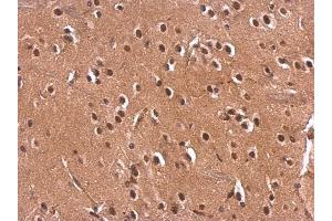 IHC-P Image Monoglyceride lipase antibody detects Monoglyceride lipase protein at nucleus on rat fore brain by immunohistochemical analysis. (MGLL 抗体)
