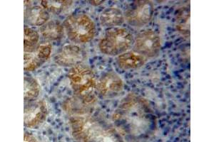 #VALUE! (Vinculin 抗体  (AA 1020-1134))