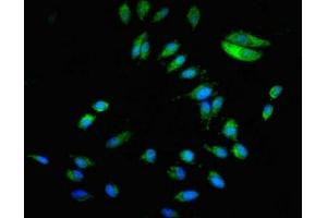 Immunofluorescent analysis of Hela cells using ABIN7145766 at dilution of 1:100 and Alexa Fluor 488-congugated AffiniPure Goat Anti-Rabbit IgG(H+L) (BCAR1 抗体  (AA 68-218))