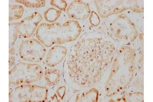 Immunohistochemistry (IHC) image for anti-Glial Cell Line Derived Neurotrophic Factor (GDNF) antibody (ABIN7127513)