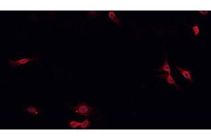 ABIN6276910 staining HepG2? (Surfactant Protein C 抗体  (N-Term))