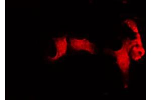ABIN6272272 staining HuvEc by IF/ICC. (CDC16 抗体  (Internal Region))