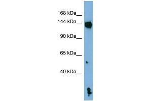 WB Suggested Anti-NLRP1 Antibody Titration: 0. (NLRP1 抗体  (N-Term))