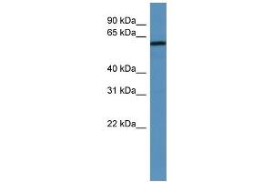 WB Suggested Anti-MAGED2 Antibody Titration: 0. (MAGED2 抗体  (N-Term))