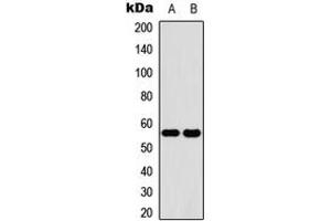 Western blot analysis of Cytochrome P450 2C19 expression in HeLa (A), human liver (B) whole cell lysates. (CYP2C19 抗体  (Center))