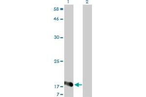 Western Blot analysis of NUDT2 expression in transfected 293T cell line by NUDT2 monoclonal antibody (M01), clone 4A4-3C3. (NUDT2 抗体  (AA 1-147))