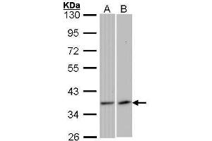 WB Image Sample (30 ug of whole cell lysate) A: 293T B: Raji 10% SDS PAGE antibody diluted at 1:1000 (VEGFD 抗体)