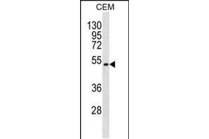 Western blot analysis in CEM cell line lysates (35ug/lane). (TOM1L2 抗体  (C-Term))