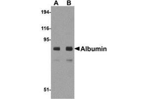 Western blot analysis of Albumin in mouse liver tissue lysate with Albumin antibody at (A) 1 and (B) 2 μg/ml. (Albumin 抗体  (Center))