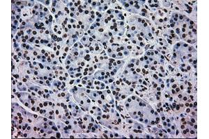 Immunohistochemistry (IHC) image for anti-Mitogen-Activated Protein Kinase 1 (MAPK1) antibody (ABIN1499293)
