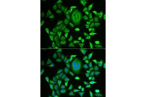 Immunofluorescence analysis of MCF-7 cells using RBP3 antibody (ABIN5973804). (RBP3 抗体)