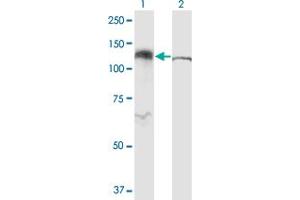 Western Blot analysis of IPO5 expression in transfected 293T cell line by RANBP5 monoclonal antibody (M01), clone 1C4. (Importin 5 抗体  (AA 1-100))
