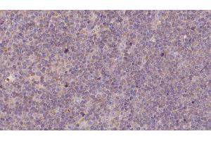 Immunohistochemistry (IHC) image for anti-NADH Dehydrogenase (Ubiquinone) 1 beta Subcomplex, 11, 17.3kDa (NDUFB11) (N-Term) antibody (ABIN6263564)