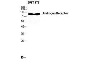 Western Blotting (WB) image for anti-Androgen Receptor (AR) (Ser154) antibody (ABIN3173851) (Androgen Receptor 抗体  (Ser154))