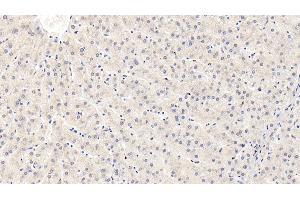Detection of IGFBP3 in Human Liver Tissue using Monoclonal Antibody to Insulin Like Growth Factor Binding Protein 3 (IGFBP3) (IGFBP3 抗体  (AA 135-277))