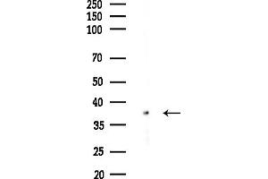 anti-Capping Protein (Actin Filament), Gelsolin-Like (CAPG) (Internal Region) antibody